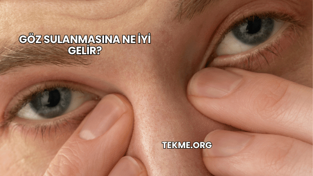 Göz Sulanmasına Ne İyi Gelir?