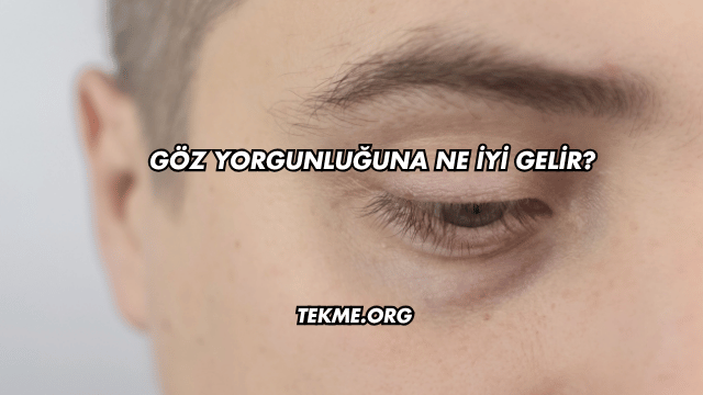 Göz Yorgunluğuna Ne İyi Gelir?