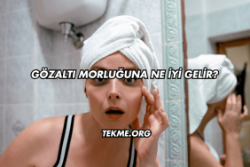 Gözaltı Morluğuna Ne İyi Gelir?