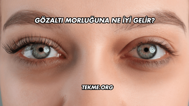Gözaltı Morluğuna Ne İyi Gelir?