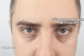 Gözaltı Torbalarına Ne İyi Gelir?