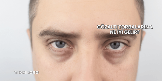 Gözaltı Torbalarına Ne İyi Gelir?