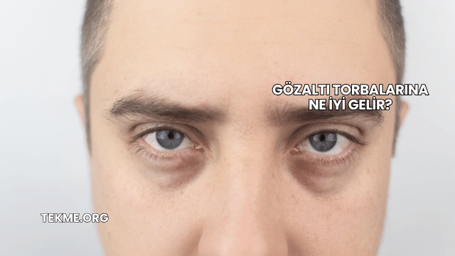 Gözaltı Torbalarına Ne İyi Gelir?