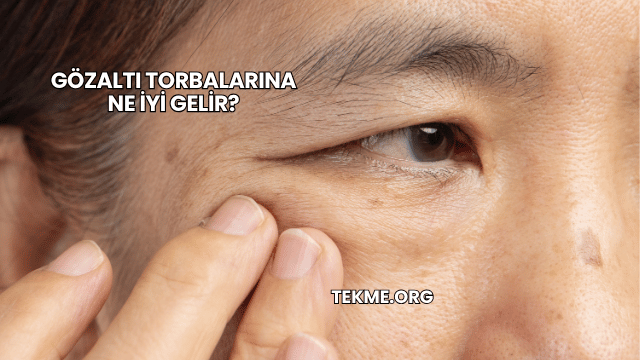 Gözaltı Torbalarına Ne İyi Gelir?