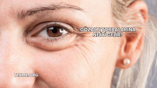 Gözaltı Torbalarına Ne İyi Gelir?