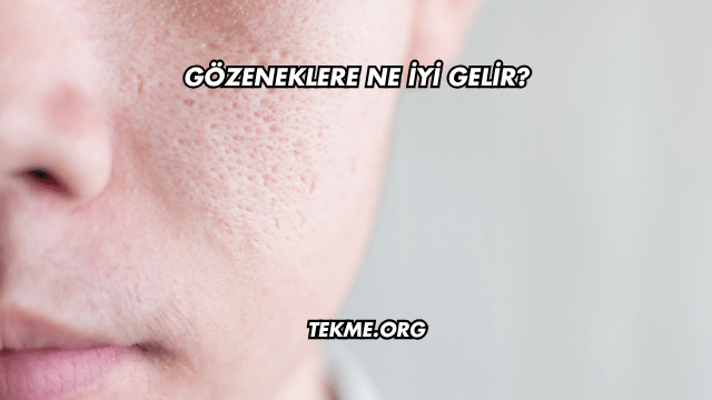 Gözeneklere Ne İyi Gelir?