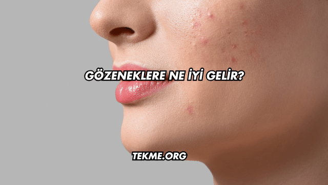 Gözeneklere Ne İyi Gelir?