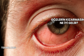 Gözlerin Kızarmasına Ne İyi Gelir?