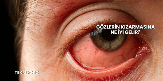 Gözlerin Kızarmasına Ne İyi Gelir?