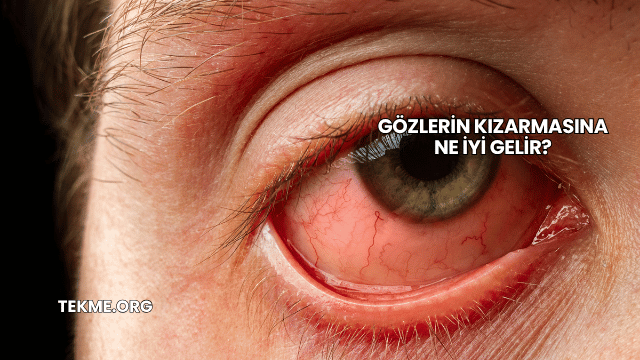 Gözlerin Kızarmasına Ne İyi Gelir?