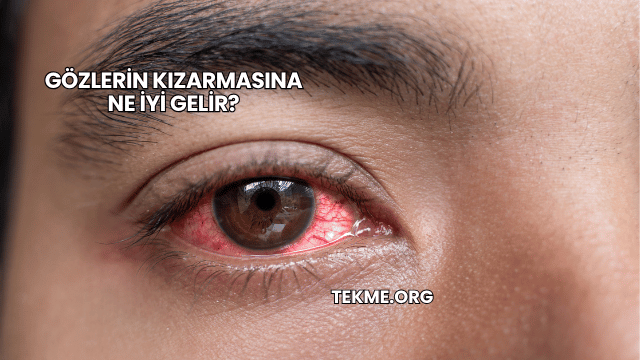 Gözlerin Kızarmasına Ne İyi Gelir?