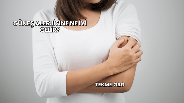 Güneş Alerjisine Ne İyi Gelir?