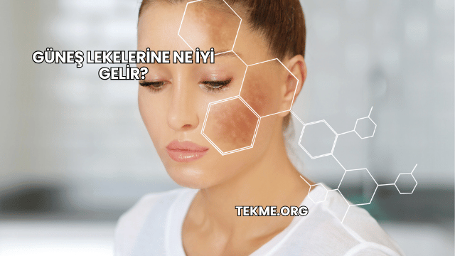 Güneş Lekelerine Ne İyi Gelir?