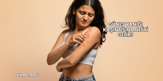 Güneş Yanığı Kaşıntısına Ne İyi Gelir?
