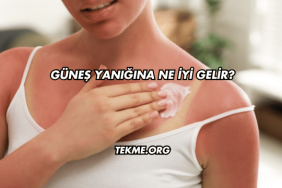 Güneş Yanığına Ne İyi Gelir?