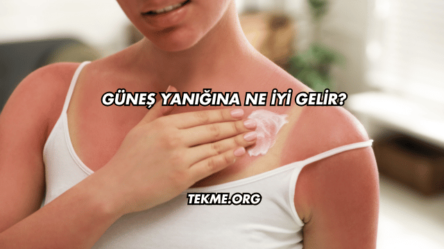 Güneş Yanığına Ne İyi Gelir?