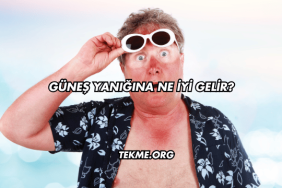 Güneş Yanığına Ne İyi Gelir?