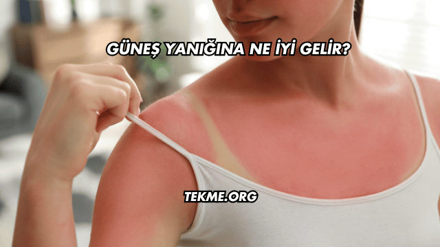 Güneş Yanığına Ne İyi Gelir?