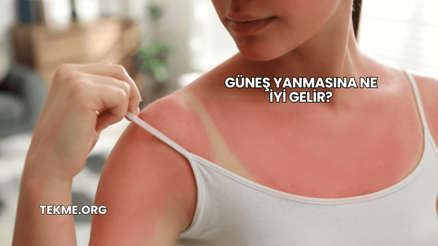 Güneş Yanmasına Ne İyi Gelir?