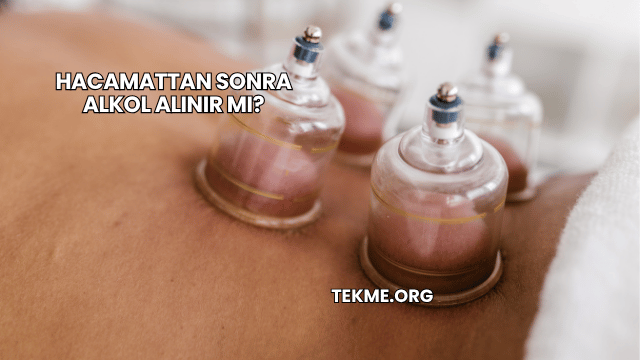 Hacamattan Sonra Alkol Alınır mı?