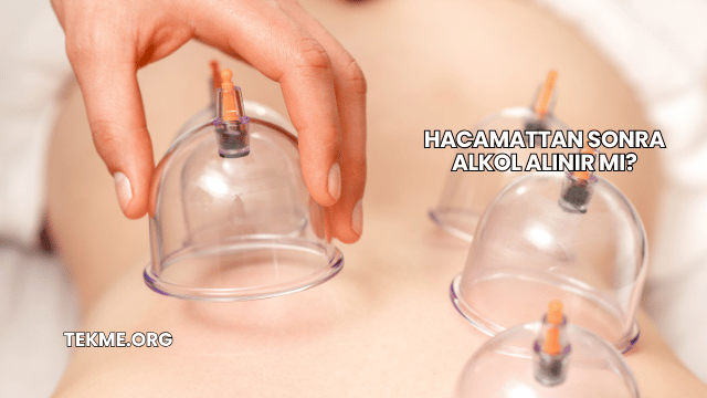 Hacamattan Sonra Alkol Alınır mı?