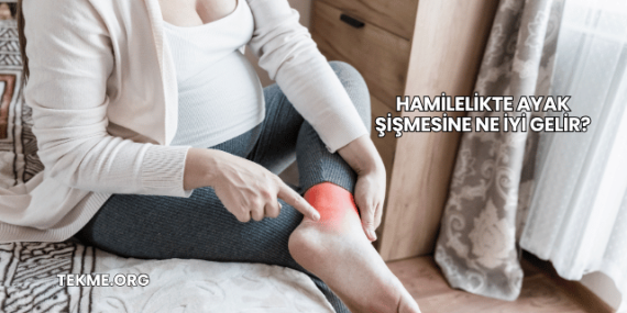 Hamilelikte Ayak Şişmesine Ne İyi Gelir?