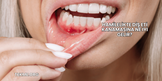 Hamilelikte Diş Eti Kanamasına Ne İyi Gelir?