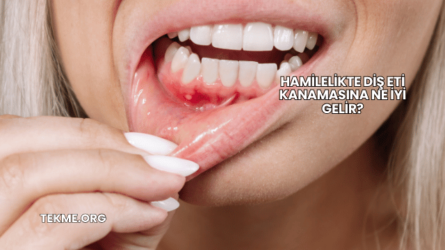 Hamilelikte Diş Eti Kanamasına Ne İyi Gelir?