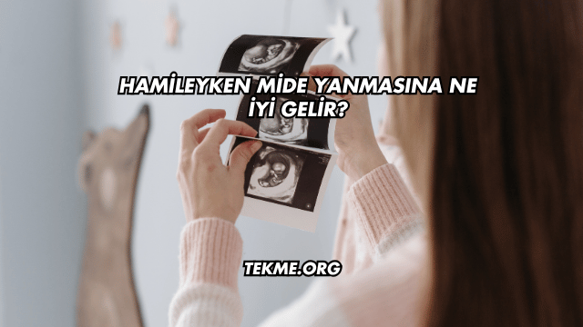 Hamileyken Mide Yanmasına Ne İyi Gelir?