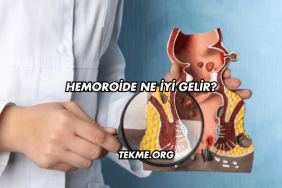 Hemoroide Ne İyi Gelir?