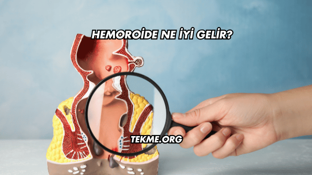 Hemoroide Ne İyi Gelir?