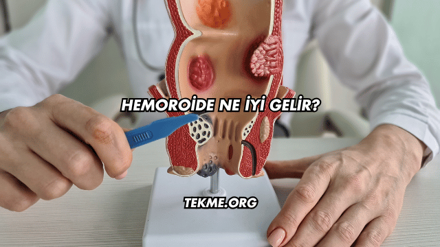 Hemoroide Ne İyi Gelir?