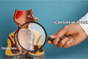 İç Basura Ne İyi Gelir?