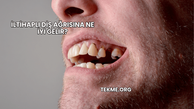 İltihaplı Diş Ağrısına Ne İyi Gelir?