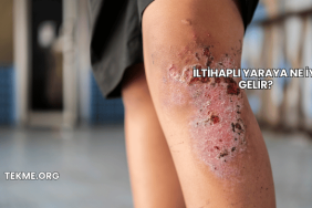 İltihaplı Yaraya Ne İyi Gelir?