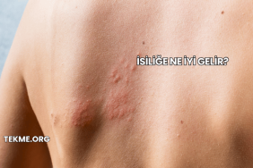 İsiliğe Ne İyi Gelir?