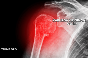 Kaburga Kırığına Ne İyi Gelir?