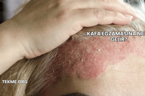 Kafa Egzamasına Ne İyi Gelir?