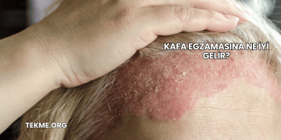 Kafa Egzamasına Ne İyi Gelir?