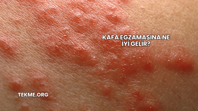 Kafa Egzamasına Ne İyi Gelir?