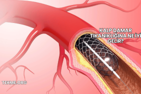 Kalp Damar Tıkanıklığına Ne İyi Gelir?