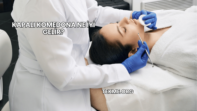 Kapalı Komedona Ne İyi Gelir?