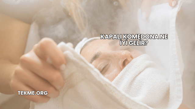 Kapalı Komedona Ne İyi Gelir?