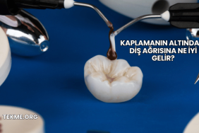 Kaplamanın Altındaki Diş Ağrısına Ne İyi Gelir?