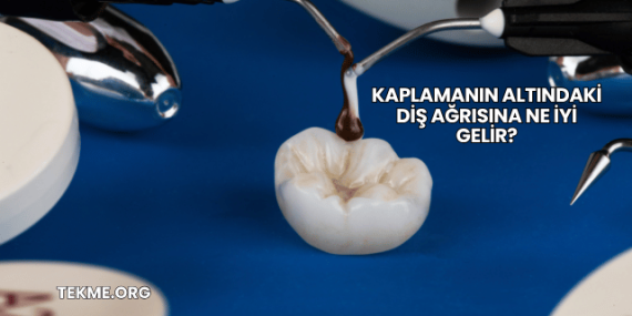 Kaplamanın Altındaki Diş Ağrısına Ne İyi Gelir?