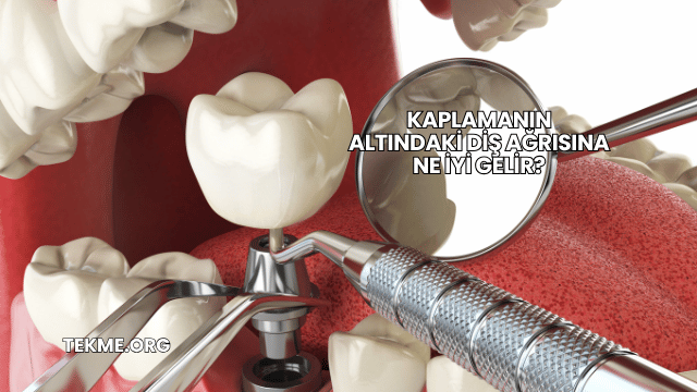 Kaplamanın Altındaki Diş Ağrısına Ne İyi Gelir?