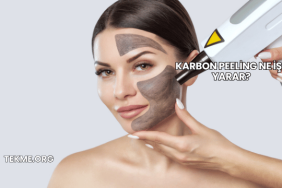 Karbon Peeling Ne İşe Yarar?