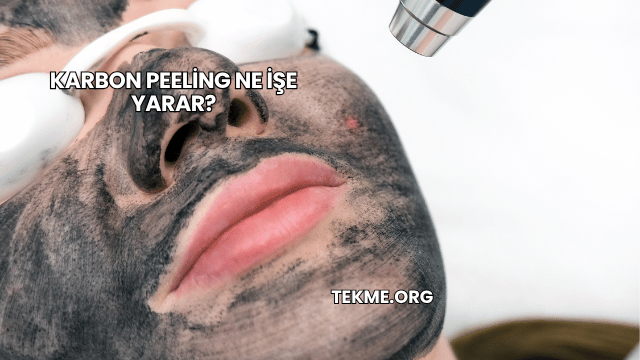 Karbon Peeling Ne İşe Yarar?