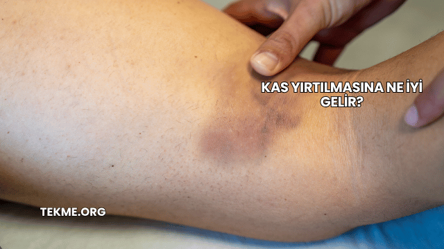 Kas Yırtılmasına Ne İyi Gelir?