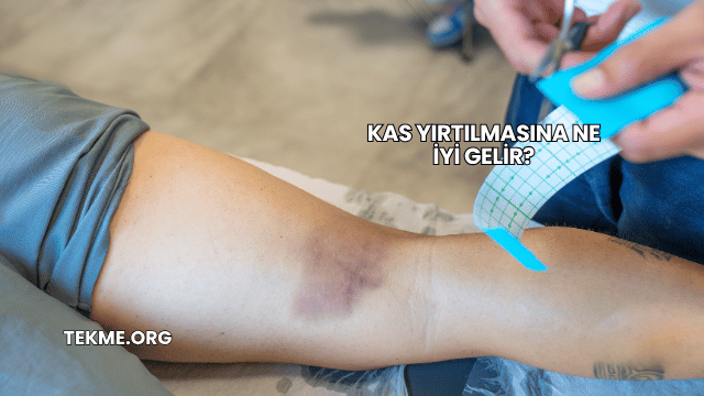 Kas Yırtılmasına Ne İyi Gelir?